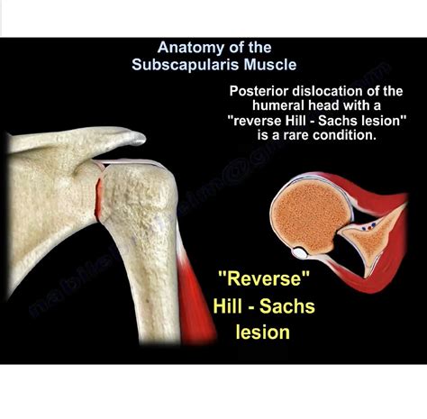 Anatomy of the Subscapularis Muscle — OrthopaedicPrinciples.com