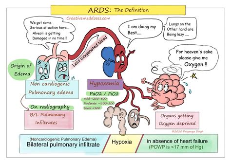 Acute Respiratory Distress Syndrome (ARDS) - Creative Med Doses