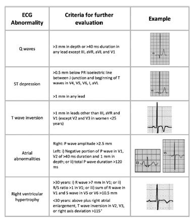 New Guidelines to Improve ECG/EKG Interpretation in Athletes - Guest ...