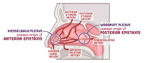 Osmosis - Epistaxis: What Is It, Types, Causes, Prevention, Treatment, and More