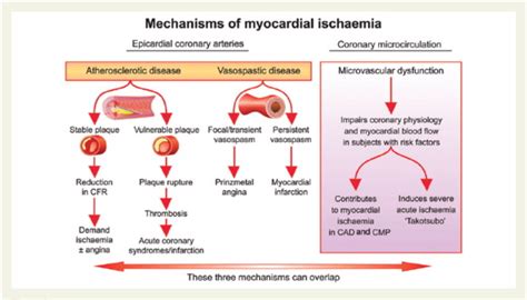 Ivabradine in chronic stable angina: Effects by and beyond heart rate reduction - International ...