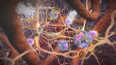 Neurotoxicity