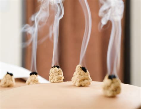 Moxibustion in Acupuncture: History, Uses, Benefits, Cautions