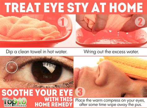 Home Remedies for Eye Sty (Stye) | Top 10 Home Remedies