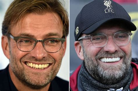 Jurgen Klopp Teeth Before And After - As Simon Cowell Shows Off ...