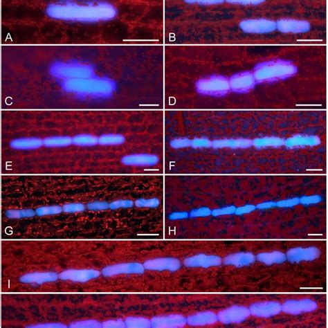 Plant and leaf structures of Egeria densa. (A) Plant stature. (B) Three... | Download Scientific ...