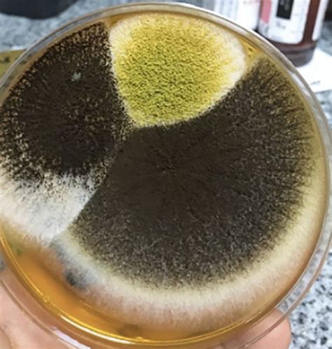 Aspergillus growth in Sabouraud dextrose agar | Download Scientific Diagram