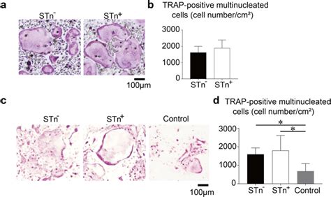 a In vitro osteoclastogenesis assay by co-culturing BMMs with either ...