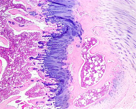 Bone Dust Histology