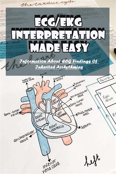 ECG/EKG Interpretation Made Easy: Information About ECG Findings Of Inherited Arrhythmias ...