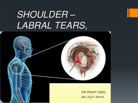 Shoulder Labral Anatomy