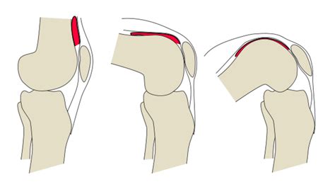 Anatomy of the Knee Joint (With Diagrams and X-Ray) - Owlcation