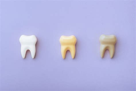 Tooth Discoloration – Causes and Solutions for Stained Teeth