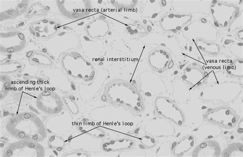 HLS [ Urinary System, kidney, medulla, vasa recta and thin loops] HIGH ...