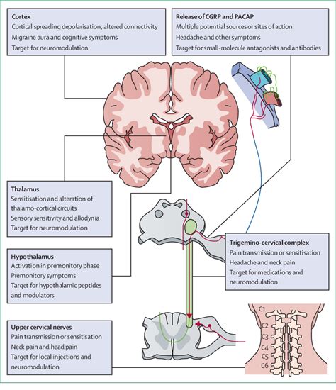 Figure 2 from Headache 2 The pathophysiology of migraine : implications ...