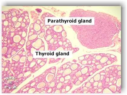 The Endocrine System, Pt. 3 : Histology-THYROID & PARATHYROID GLANDS 2/ ...