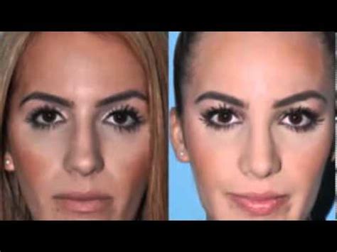 cosmetic surgeon Beverly hills - YouTube