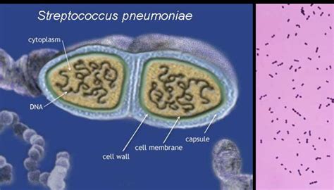 Laboratory diagnosis, Treatment and Prevention of Streptococcus pneumoniae