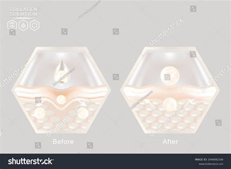 Hyaluronic Acid Before After Skin Solutions Stock Vector (Royalty Free) 2046082166 | Shutterstock