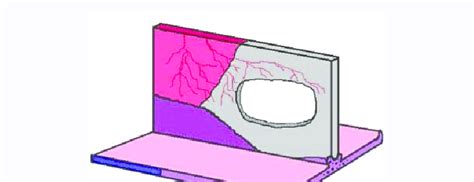 Illustration of the large septal perforation. | Download Scientific Diagram