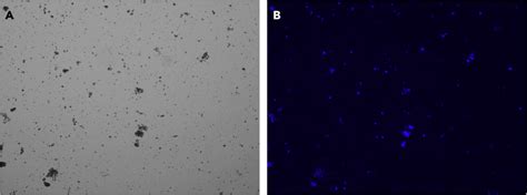 Presence of cell debris in nuclei preparation (A) The brightfield image... | Download Scientific ...