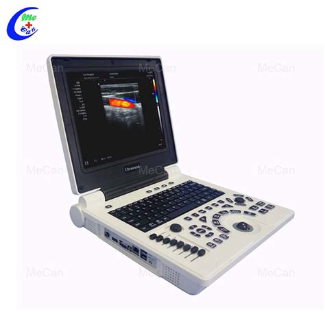 Color Doppler Ultrasound - Fetal Imaging