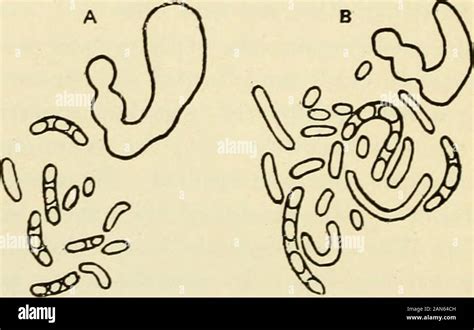 Pyloric sphincter hi-res stock photography and images - Alamy