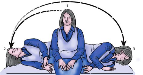 4. semont liberatory maneuver. step 1: start with the patient sitting ...