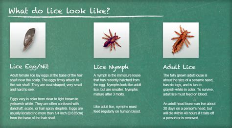 Recognize Lice | Lice Removal and Treatment | Ladibugs Clinic