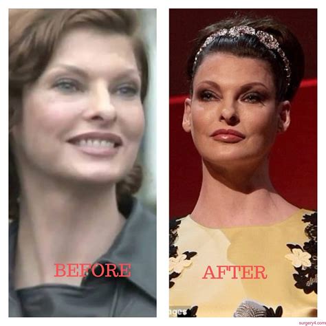 Linda Evangelista Before And After Photos