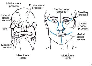 Nasolacrimal Duct Anatomy
