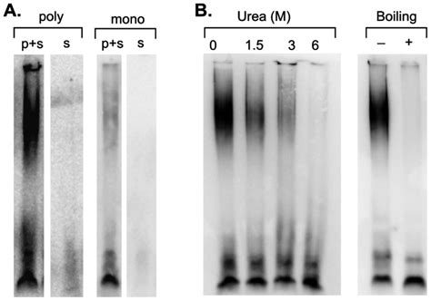 (A) Independently derived antibodies to TDP-43 bind to high-molecular ...