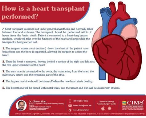 How Is a Heart Transplant Performed ? | The Best Cardiac Surgeon in ...