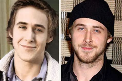 Ryan Gosling Plastic Surgery Before and After | Celebie