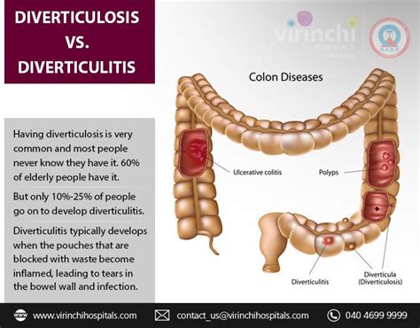 Pin on Gastroenterology