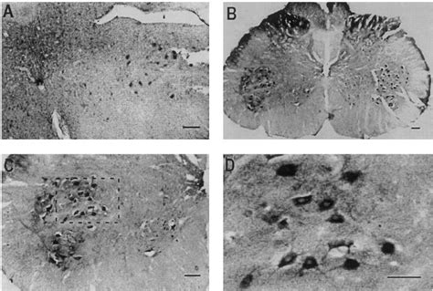 In situ hybridization with neuronal constitutive nitric oxide synthases ...