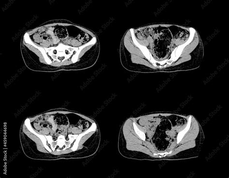 Abdomen ct scan and MRI professional images Stock Photo | Adobe Stock