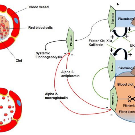 (PDF) Reperfusion therapy in acute ischemic stroke: Dawn of a new era?