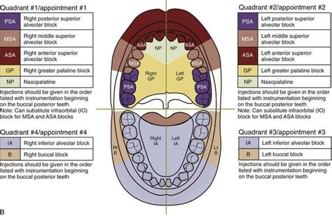 11: Basic Injection Techniques | Dental hygiene student, Dental hygiene ...