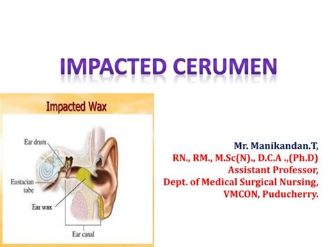 Impacted cerumen | PPT