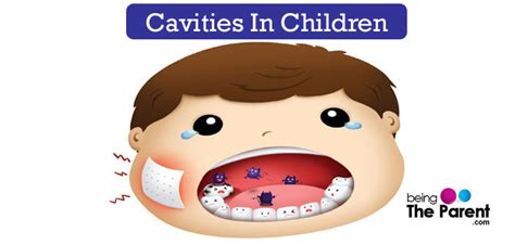 Top 10 Foods That Cause Cavities In Children - Being The Parent