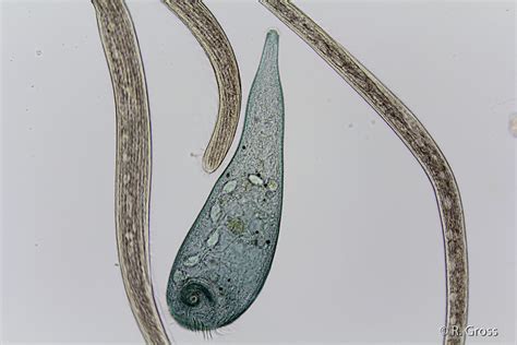 Spirostomum Under Microscope