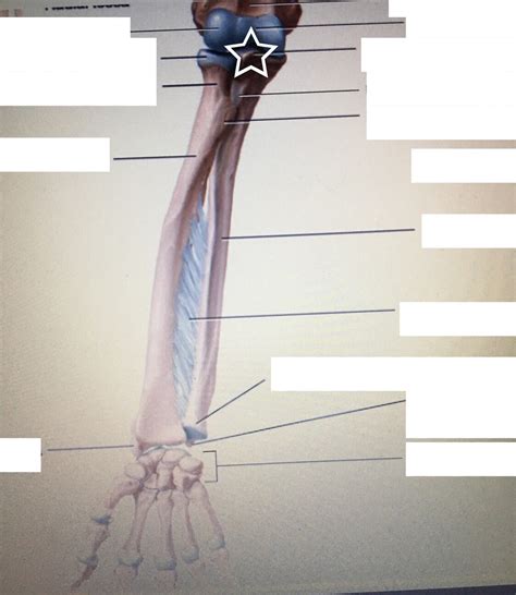 Ulna and Radius Labeling Flashcards | Memorang