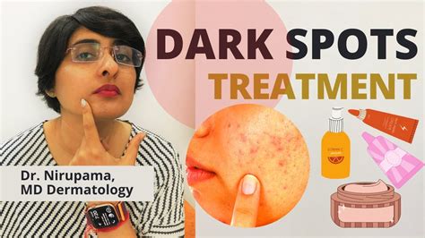 Dark Spots Treatment| How to get rid of Dark Spots| Pigmentation treatment | Dr Nirupama - YouTube