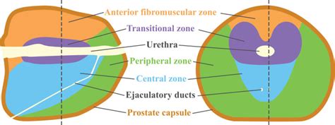 Figure 1, [Zonal anatomy of the prostate...]. - Urologic Cancers - NCBI Bookshelf