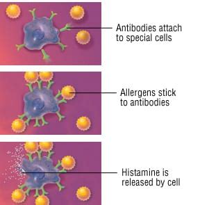 Patient Basics: Allergy Shots (Allergen Immunotherapy) | 2 Minute Medicine