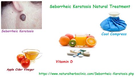 Seborrheic Keratosis Natural Treatment - Natural Herbs Clinic