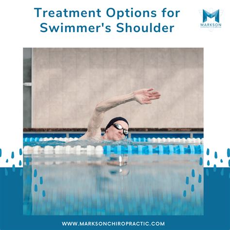 Treatment Options for Swimmer's Shoulder - Markson Chiropractic