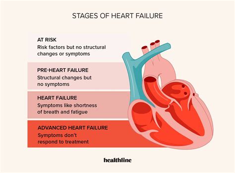 Congestive Heart Failure Stages: Treatment and Outlook