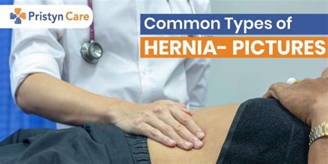 Commonly Seen Hernia Symptoms in Men - Pristyn Care